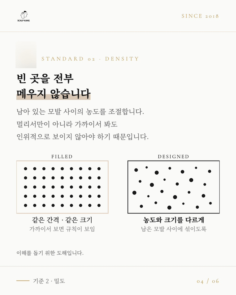 남성 정수리 두피문신 색소와 밀도 맞춤 시술