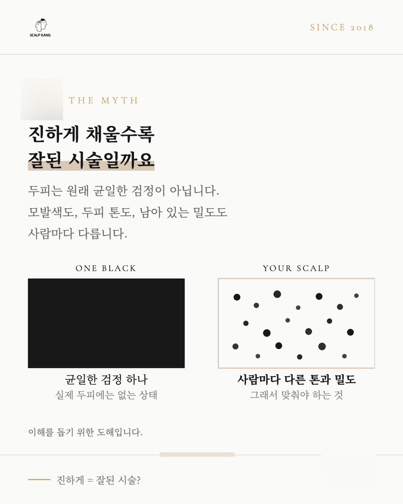 기존 모발과 자연스럽게 연결된 남성 정수리 SMP 결과