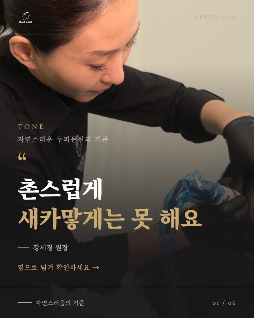 남성 정수리 두피문신으로 자연스럽게 밀도를 보완한 사례