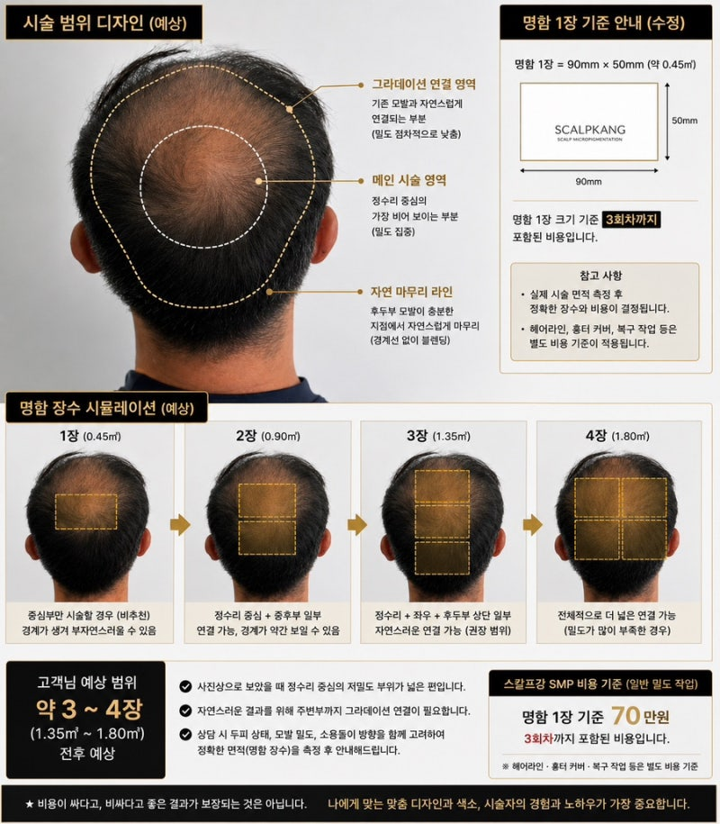명함 1장 기준 70만원 3회 포함 스칼프강 두피문신 시술 사례