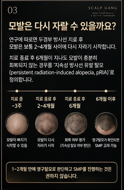 스칼프강에서는 1~2개월 만에 영구탈모로 판단하고 SMP를 진행하는 것은 권하지 않습니다. 
